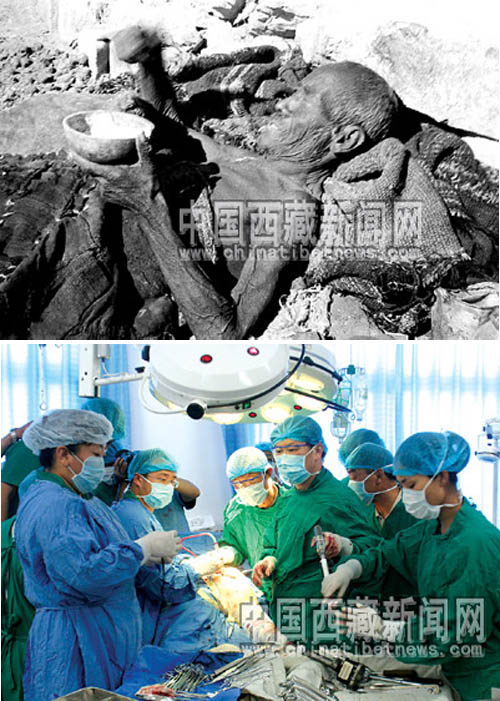 上：舊西藏有病無處就醫。下：拉薩市人民醫院的醫生為患者做手術。